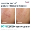 Eucerin DermoPure Clinical, kuracja złuszczająco-wygładzająca Peeling 10, z kwasem glikolowym i salicylowym, 40ml