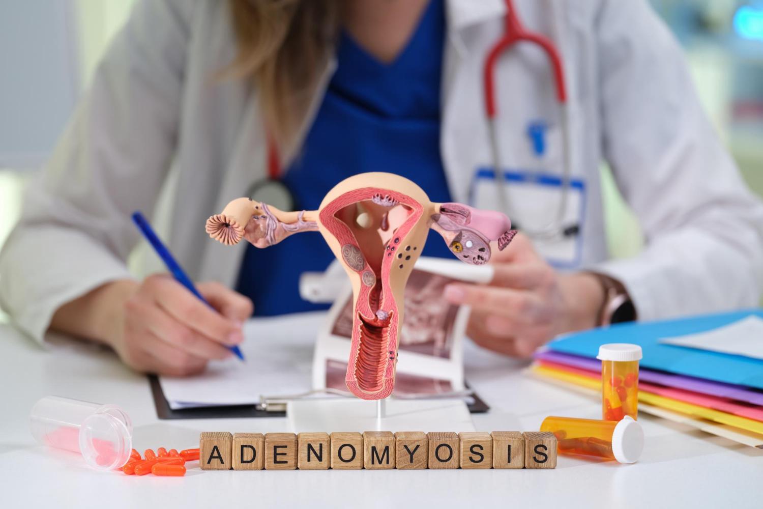 Adenomioza - objawy, przyczyny, metody leczenia
