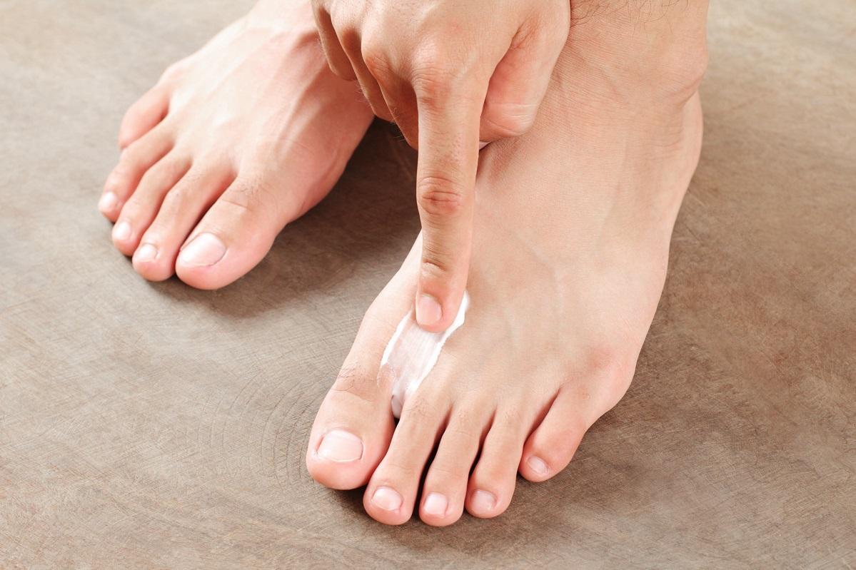 Jak poradzić sobie z grzybicą stóp i paznokci? Sprawdź porady ekspertów!