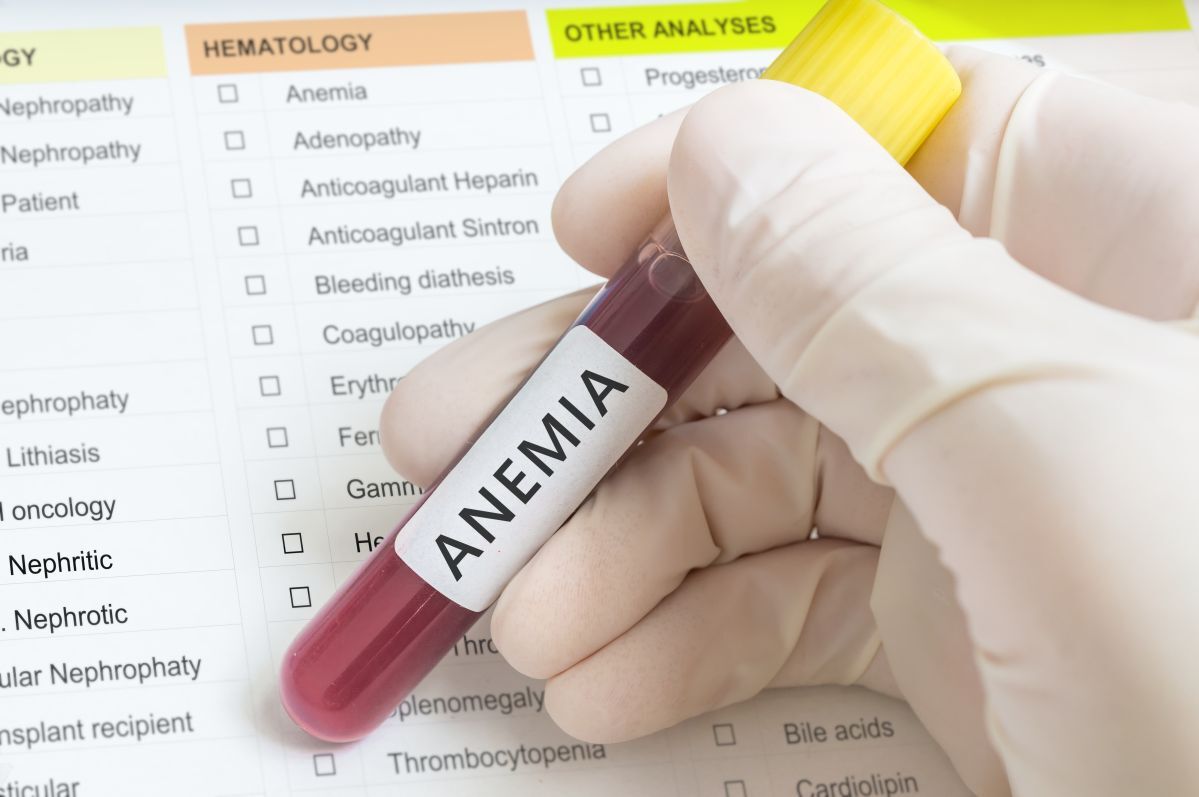 anemia-leczenie